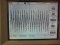 5kHz square wave, open circuit. Signal indistinguishable from switching residual and subharmonics thereof.